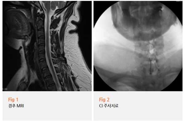 %EA%B7%B8%EB%A6%BC7.png?type=w966