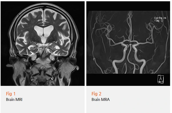 %EA%B7%B8%EB%A6%BC15.png?type=w966