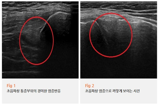 %EA%B7%B8%EB%A6%BC2.png?type=w966