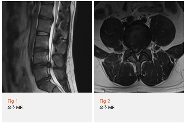 %EA%B7%B8%EB%A6%BC4.png?type=w966