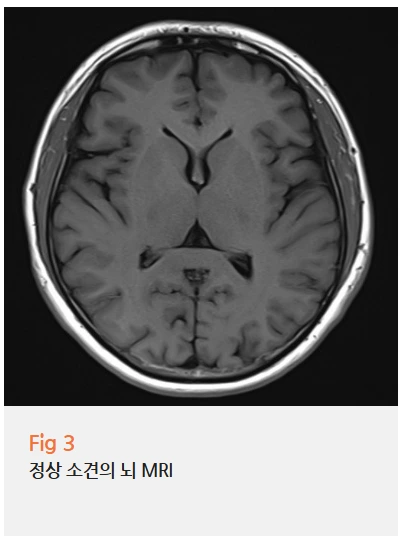 %EA%B7%B8%EB%A6%BC15.png?type=w966