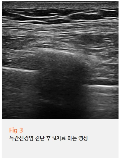 %EA%B7%B8%EB%A6%BC6.png?type=w966