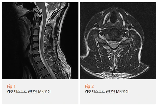 %EA%B7%B8%EB%A6%BC2.png?type=w966