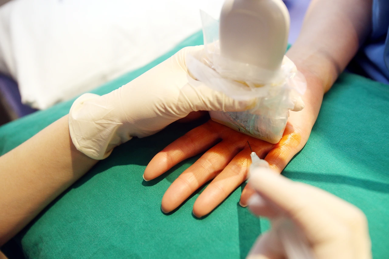 이미주원장 손가락 (2).JPG