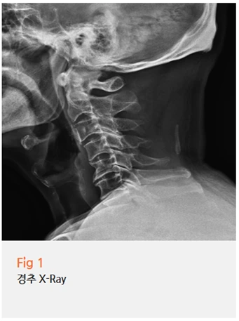 %EA%B7%B8%EB%A6%BC9.png?type=w966