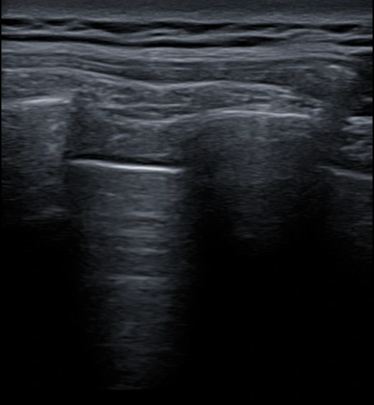 %EA%B7%B8%EB%A6%BC7.png?type=w966