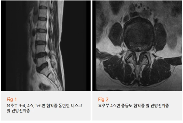 %EA%B7%B8%EB%A6%BC9.png?type=w966