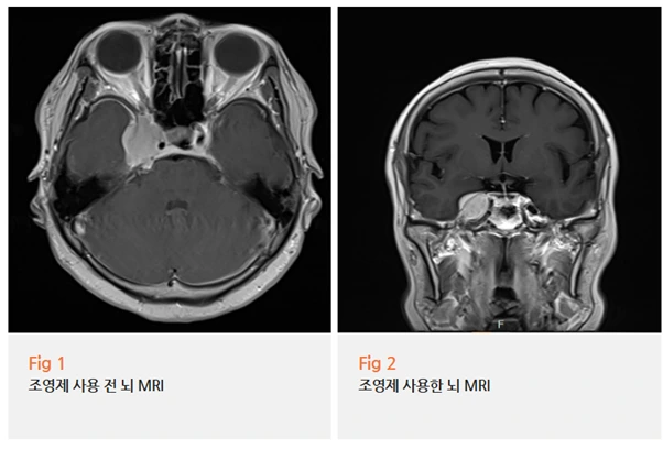 %EA%B7%B8%EB%A6%BC12.png?type=w966