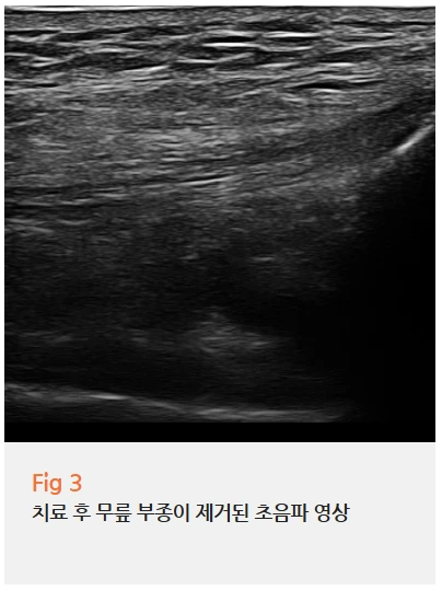 %EA%B7%B8%EB%A6%BC12.png?type=w966