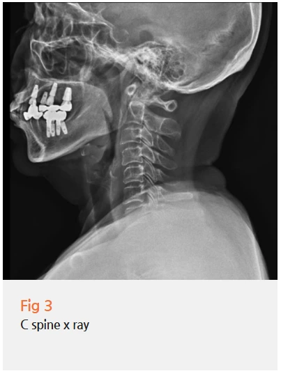 %EA%B7%B8%EB%A6%BC12.png?type=w966