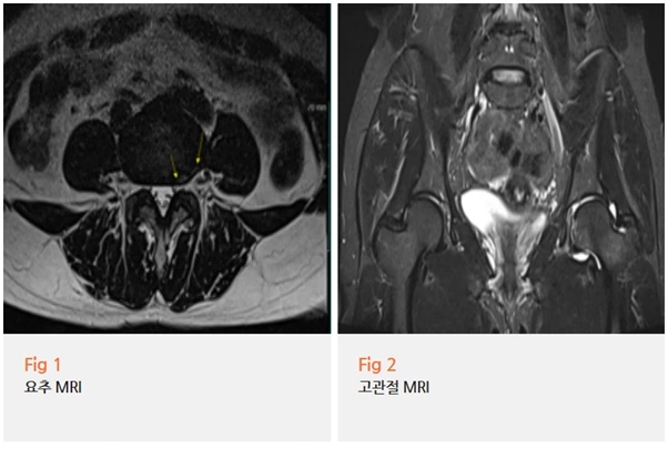 %EA%B7%B8%EB%A6%BC9.png?type=w966