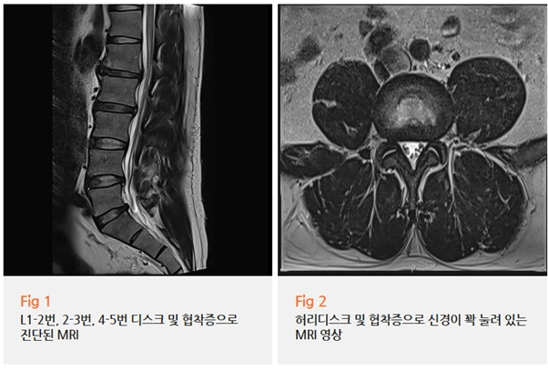 %EA%B7%B8%EB%A6%BC6.png?type=w966