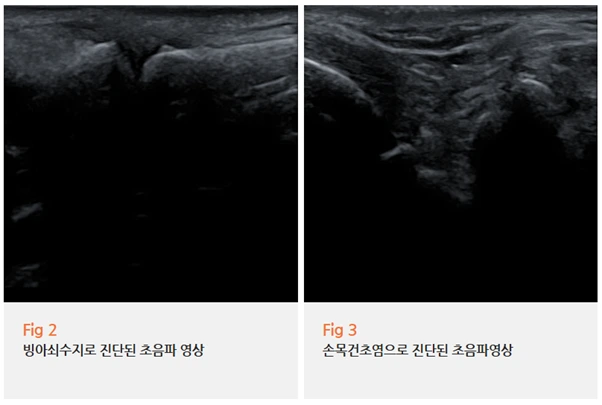 %EA%B7%B8%EB%A6%BC3.png?type=w966