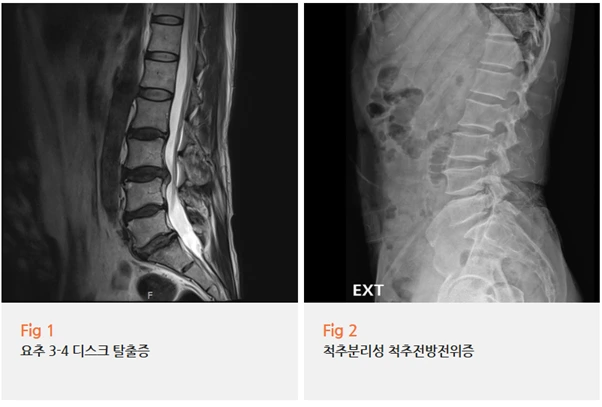 %EA%B7%B8%EB%A6%BC10.png?type=w966