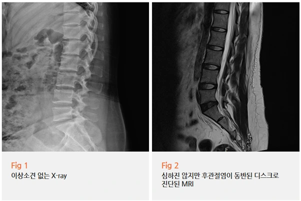 %EA%B7%B8%EB%A6%BC5.png?type=w966