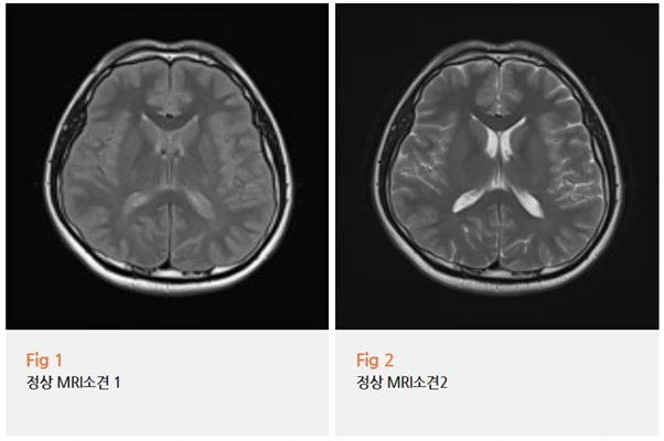 %EA%B7%B8%EB%A6%BC10.png?type=w966