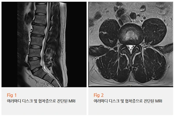 %EA%B7%B8%EB%A6%BC5.png?type=w966