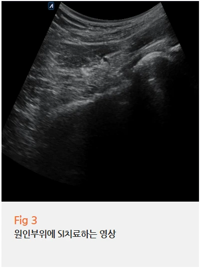 %EA%B7%B8%EB%A6%BC8.png?type=w966