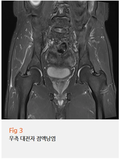 %EA%B7%B8%EB%A6%BC11.png?type=w966