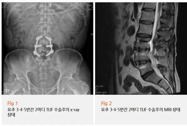 %EA%B7%B8%EB%A6%BC18.png?type=w966