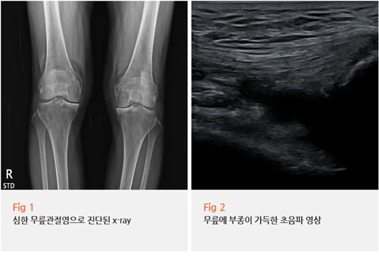 %EA%B7%B8%EB%A6%BC10.png?type=w966