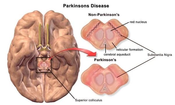 %EA%B7%B8%EB%A6%BC4.jpg?type=w966