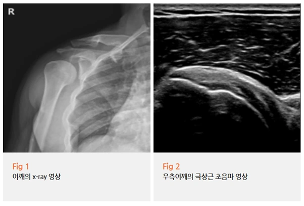 %EA%B7%B8%EB%A6%BC18.png?type=w966