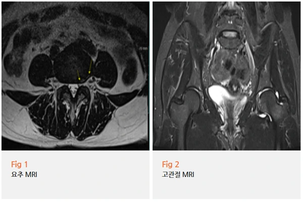 %EA%B7%B8%EB%A6%BC3.png?type=w966