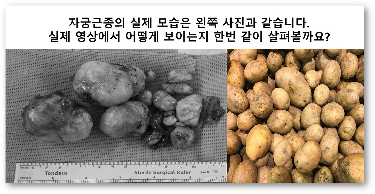 %EC%8B%A4%EC%A0%9C%EB%AA%A8%EC%8A%B5.jpg?zoom=1.25&w=640&ssl=1