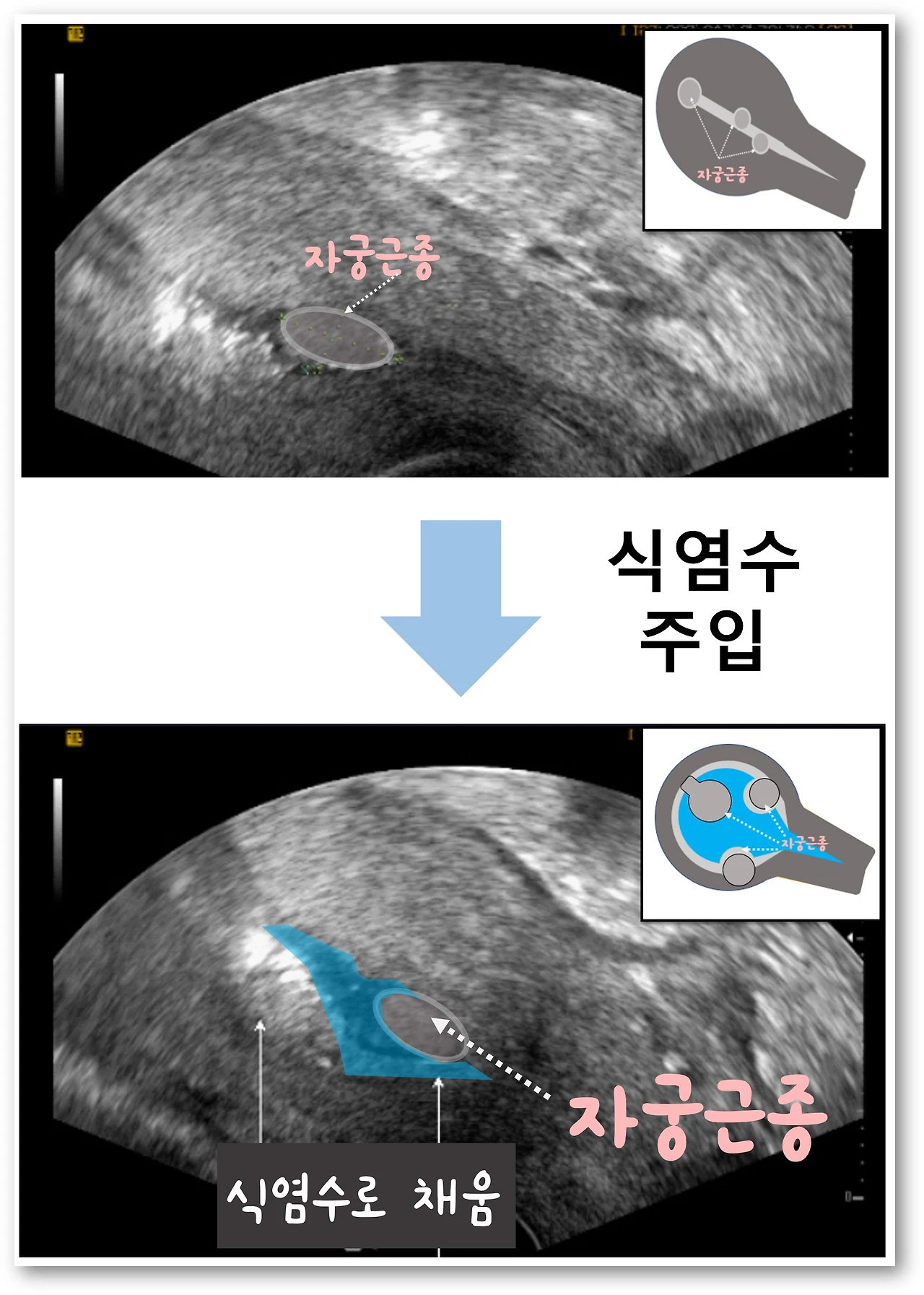 SIS.jpg?zoom=1.25&w=640&ssl=1