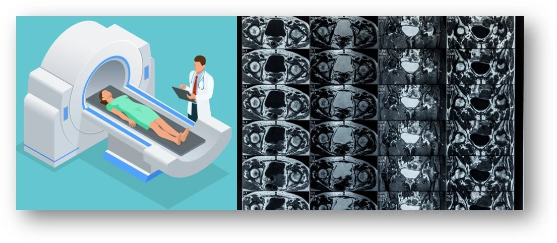 MRI%20%EC%98%81%EC%83%812.jpg?zoom=1.25&w=640&ssl=1