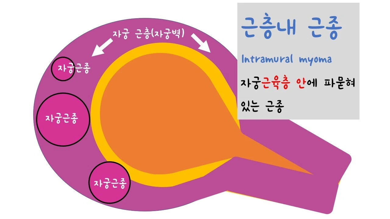 %EC%8A%AC%EB%9D%BC%EC%9D%B4%EB%93%9C6.JPG?zoom=1.25&amp;w=640&amp;ssl=1