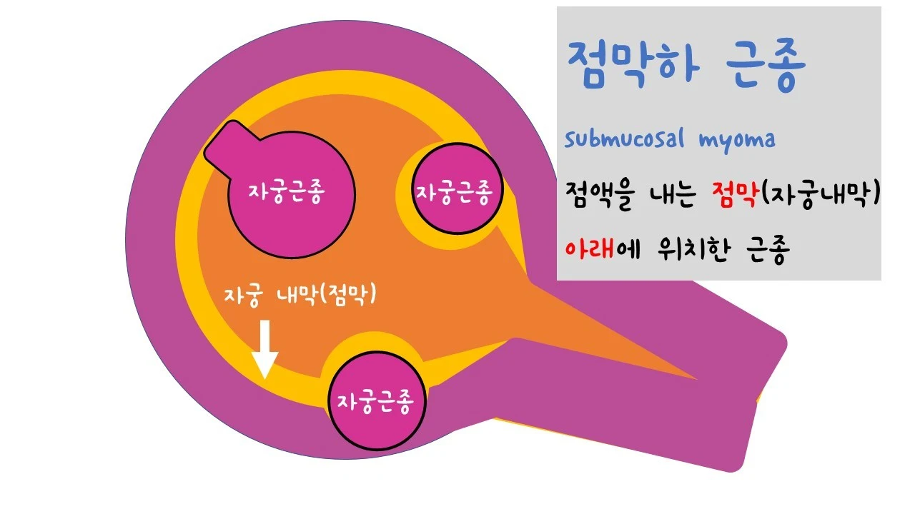 %EC%8A%AC%EB%9D%BC%EC%9D%B4%EB%93%9C5.JPG?zoom=1.25&amp;w=640&amp;ssl=1