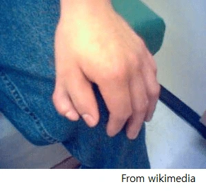 image-1531439228403.png?resize=299%2C277&ssl=1