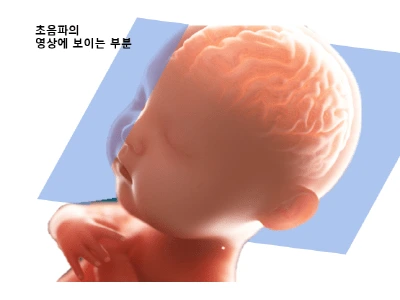 unnamed-file-2.png?resize=400%2C300&ssl=1