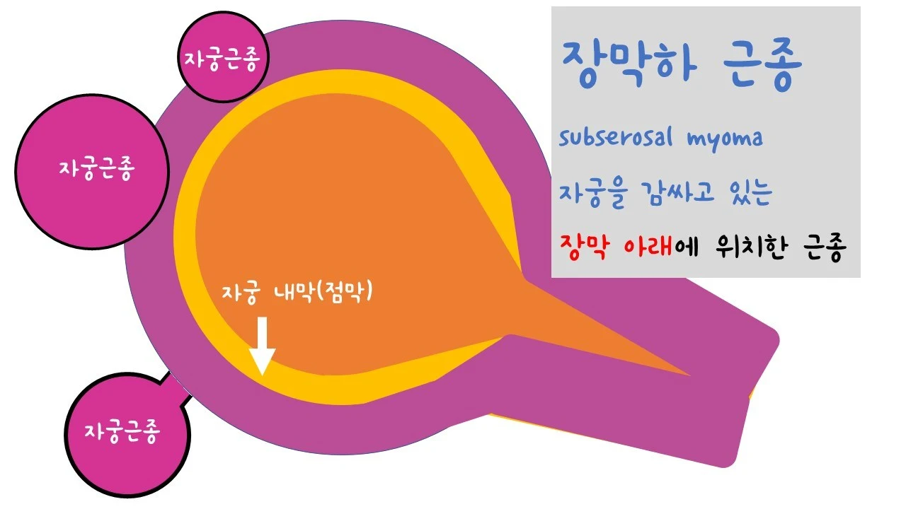 %EC%8A%AC%EB%9D%BC%EC%9D%B4%EB%93%9C7.JPG?zoom=1.25&amp;w=640&amp;ssl=1