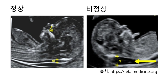 image.png?w=640&ssl=1