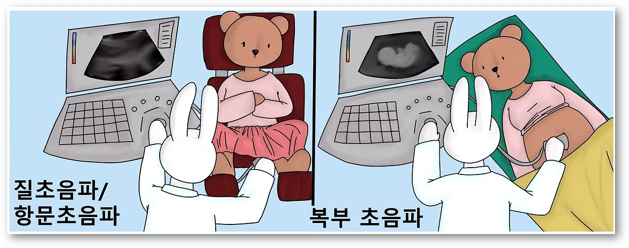 %EC%B4%88%EC%9D%8C.jpg?zoom=1.25&w=640&ssl=1