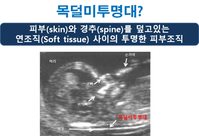 image-1531439250711.png?resize=640%2C439&ssl=1