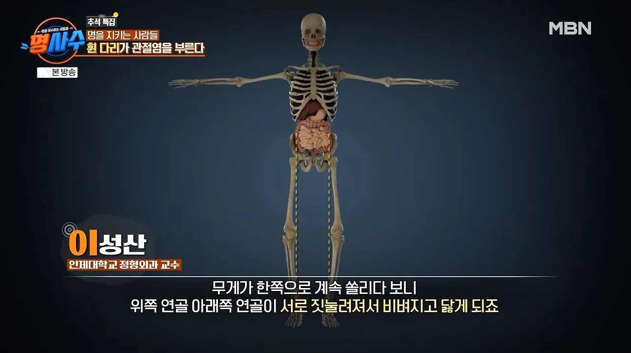 명사수_정형외과 이성산 교수8.JPG