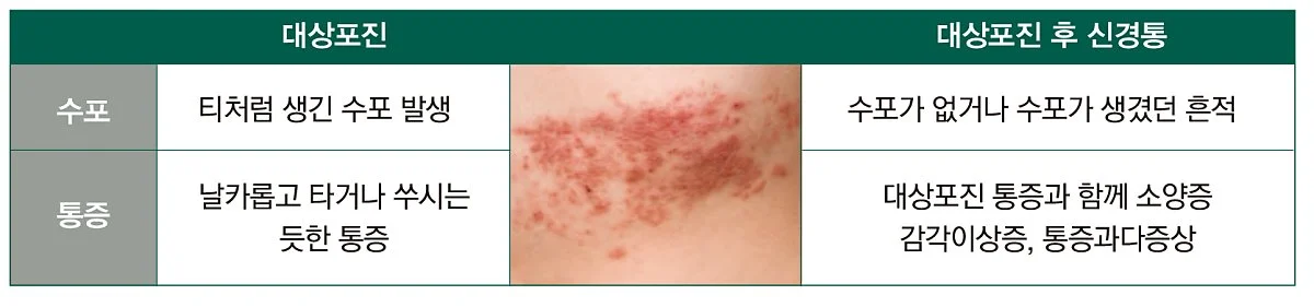 %EB%8C%80%EC%83%81%ED%8F%AC%EC%A7%84_%EB%8C%80%EC%83%81%ED%8F%AC%EC%A7%84%EC%8B%A0%EA%B2%BD%ED%86%B5%EC%B0%A8%EC%9D%B4.jpg?type=w1200