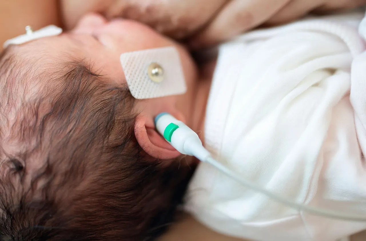 선청성 소아 난청1.JPG