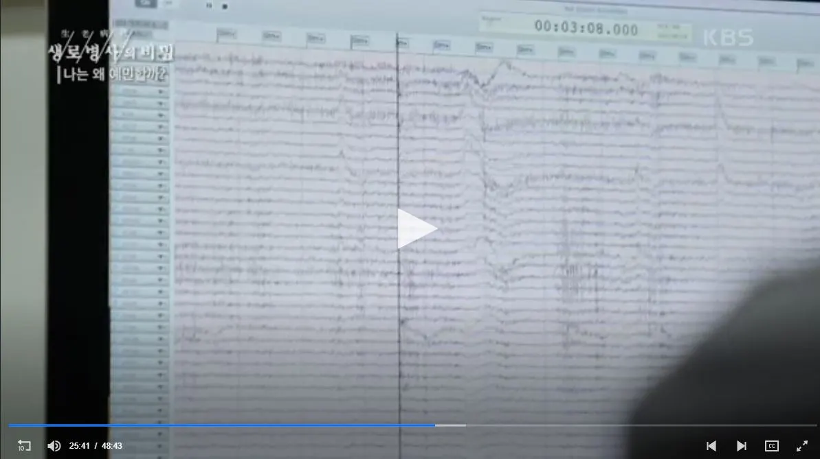 이승환 교수 생로병사5.JPG