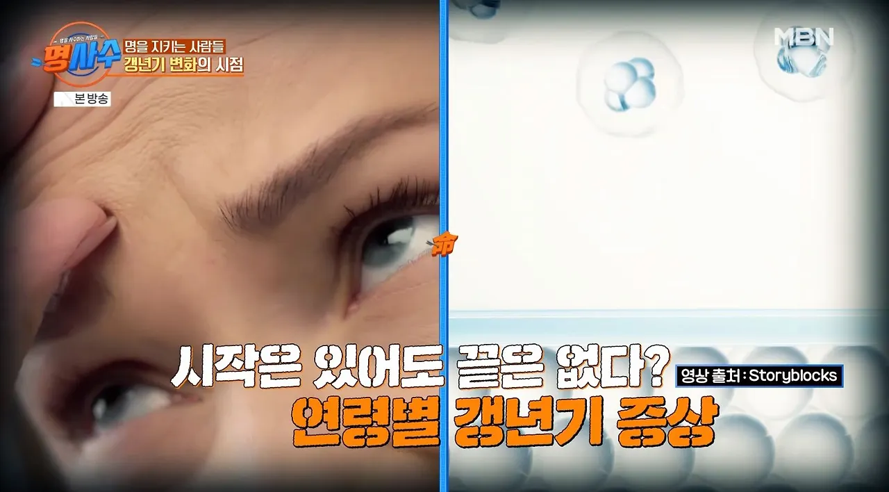 mbn 명사수 산부인과 김영아 교수10.JPG