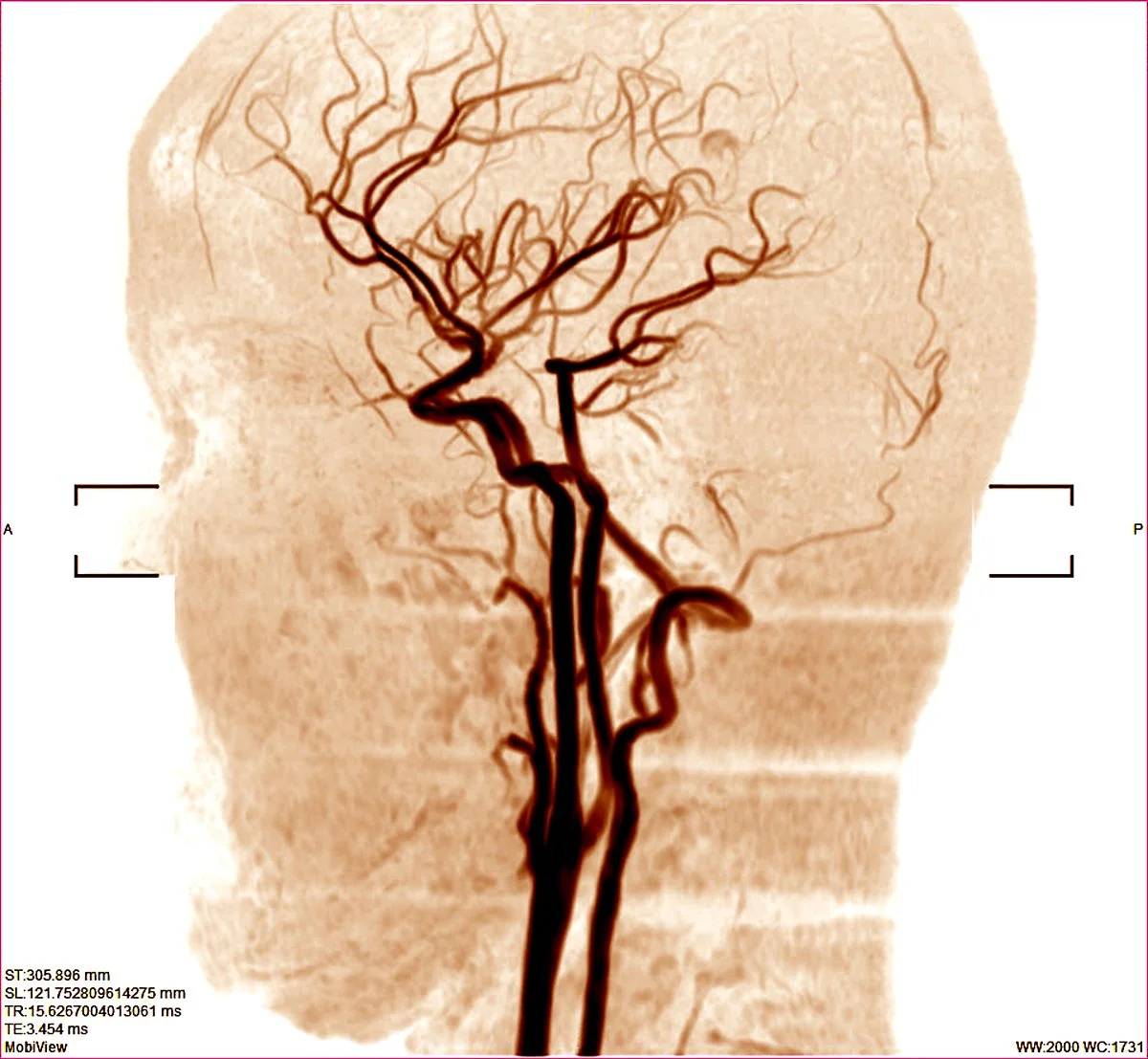 GettyImages-1207432838.jpg?type=w1200