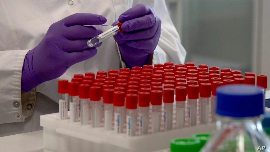 43e520feae1d084746a54385180c7d26.jpg?itok=FVUs1nnQ