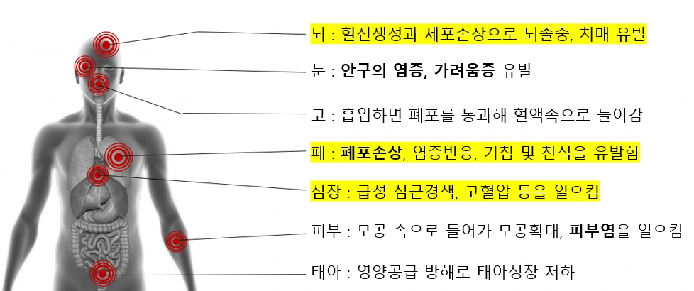 미세먼지 인체피해.PNG