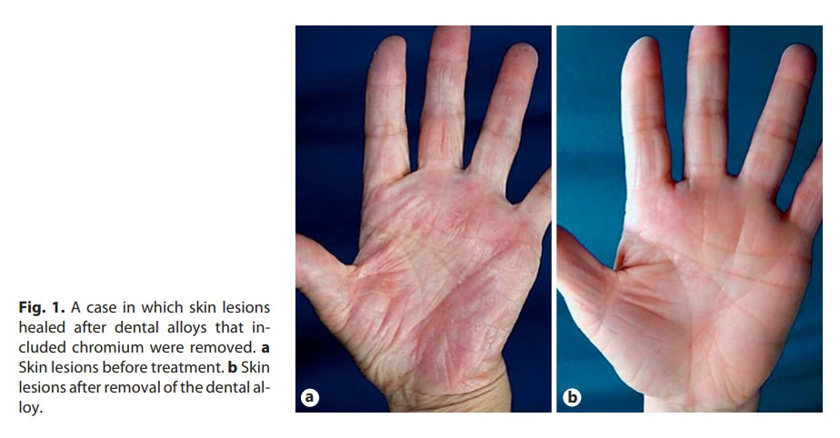 scbyNSCrpBccaGe8eWM5mGV1u5mK4gx5TZ84jytV7wkkZnhn8Ok7KUKuG5GXArmVZGLxbXdCmeOuHEEKqKo7Dx8ZRQ_UjpVPUHJ0Zd-9bqlq1Rhg6ZLwRgR2U3Fi25QgkBG9j18a