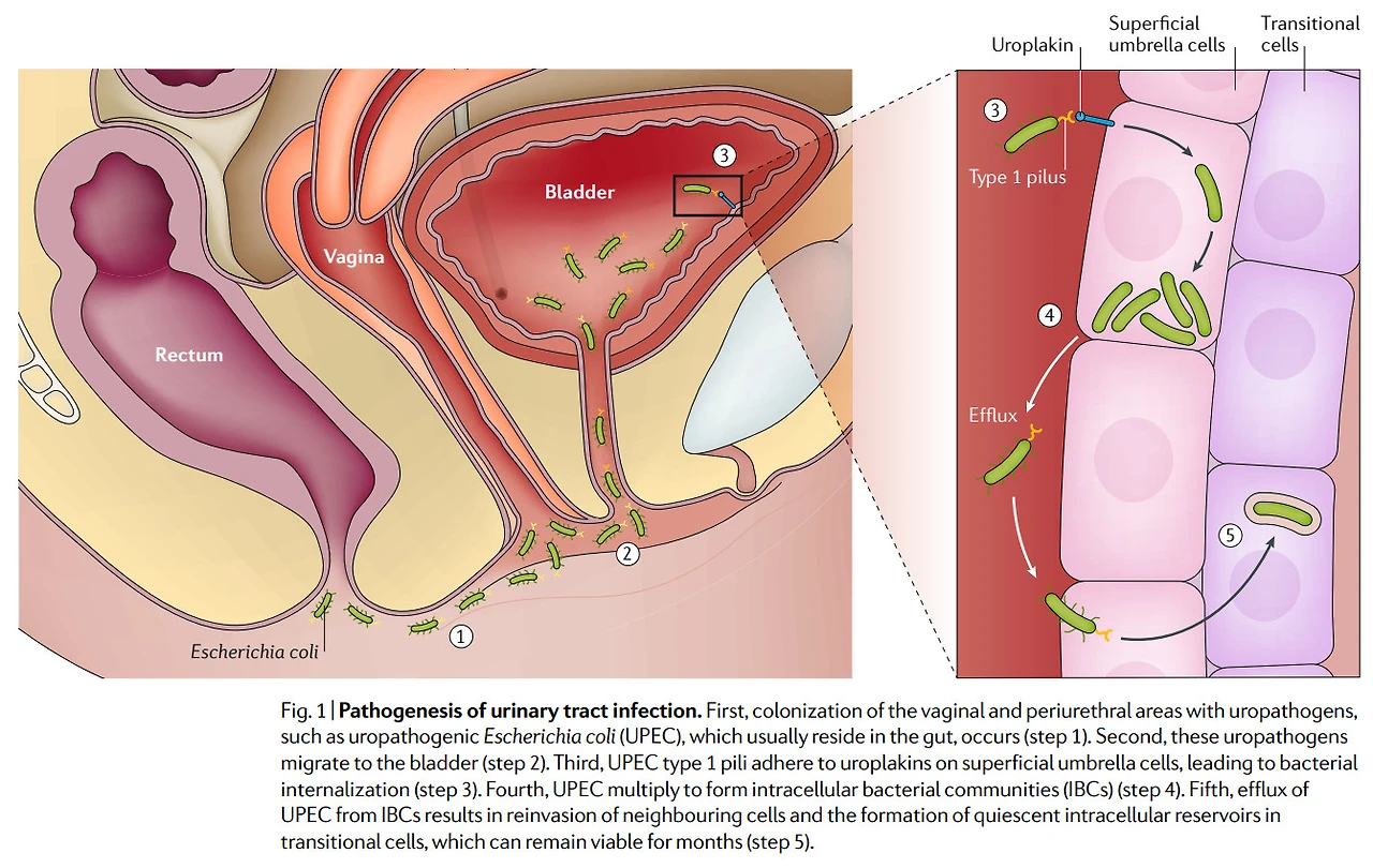 mWyYTjuCiu8PyE_EEyaZVJ7o0WF8Ivw5pdCk7l-ELtHElxyAYe93BYYynAoqyqAHBjJdOLTaAs5wMuHsdtPsDW5fJ0og0VyUuqNOfthjxj8r7rK8q3tdZ26_15NPbx0_B5EdMIOO