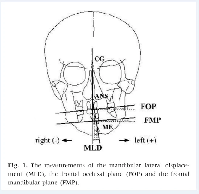 jCVnEQkE93ToLzv56osHu2W7BmBY8dnIMPcxuyu5Wecwy5eSOyUyNCKFiQbGN66VlrTvnn4IFKtSqCpxZXho0xOEpodGn9StI8IS3TZbDUkWezqIXAwKReLmmeOvxXybQnhNwj1f
